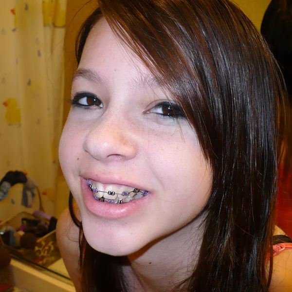 Your Orthodontist Has Daily Tips for Braces-Wearers - MyOrthodontist - orthodontist,braces,paterson orthodontist braces Paterson